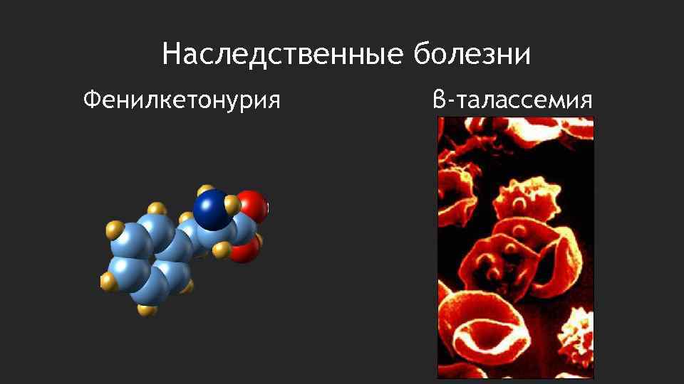 Наследственные болезни Фенилкетонурия β-талассемия 