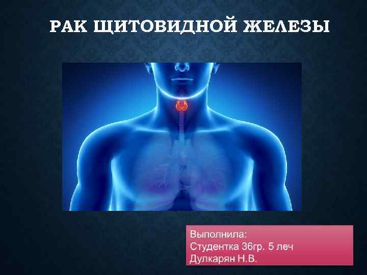 Рак щитовидной железы фото шеи