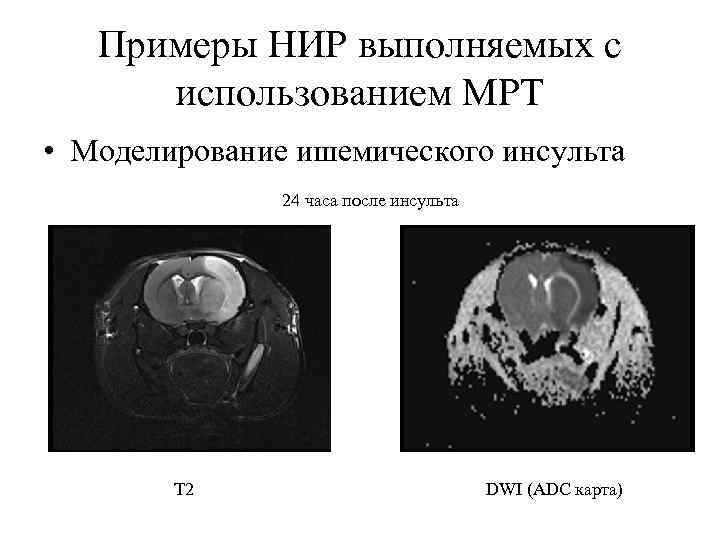 Примеры НИР выполняемых с использованием МРТ • Моделирование ишемического инсульта 24 часа после инсульта