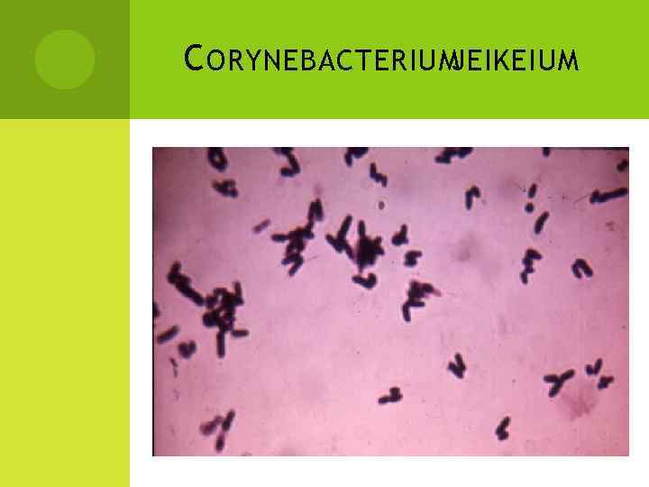 C ORYNEBACTERIUM JEIKEIUM 