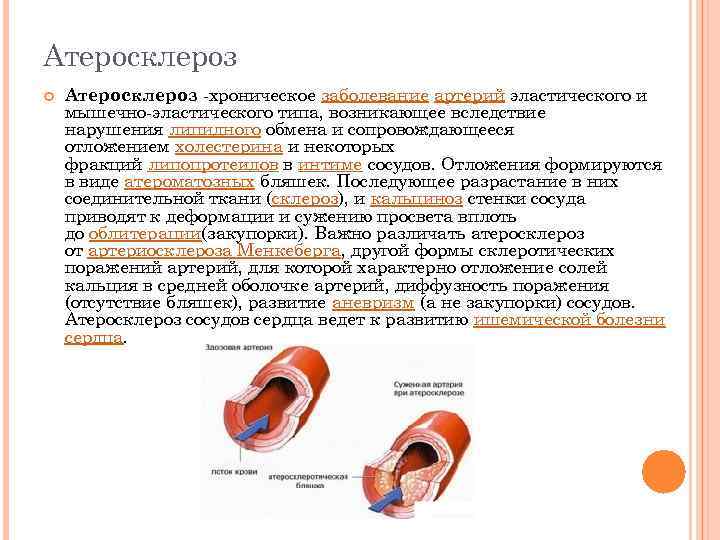Атеросклероз -хроническое заболевание артерий эластического и мышечно-эластического типа, возникающее вследствие нарушения липидного обмена и