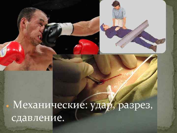1. Механические: удар, разрез, сдавление. 