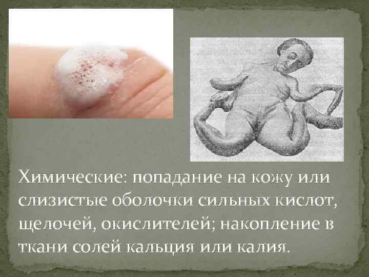 Химические: попадание на кожу или слизистые оболочки сильных кислот, щелочей, окислителей; накопление в ткани