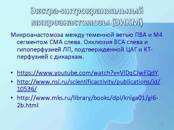 Экстра-интрокраниальный микроанастомозы (ЭИКМ) Микроанастомоза между теменной ветью ПВА и М 4 сегментом СМА слева.