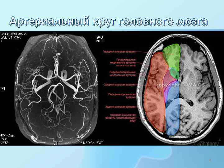 Артериальный круг головного мозга 4 