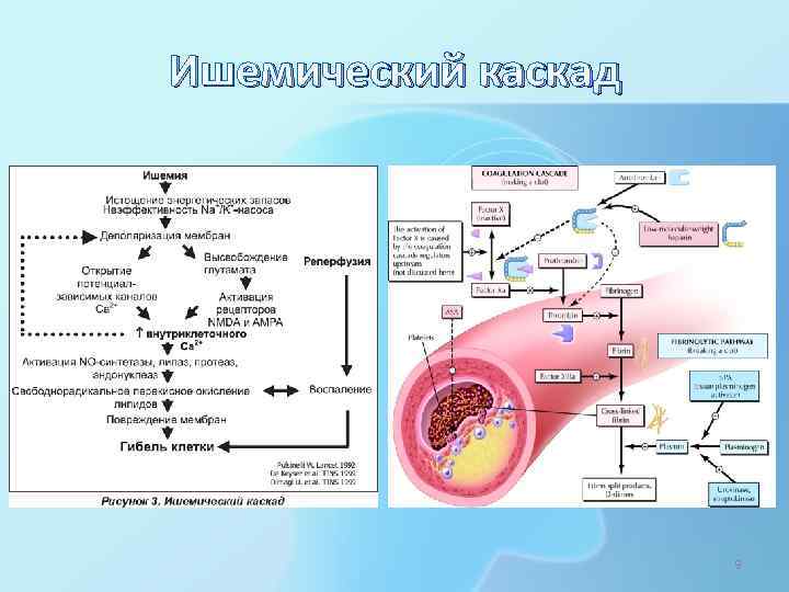 Ишемический каскад 9 