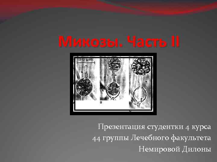 Микозы. Часть II Презентация студентки 4 курса 44 группы Лечебного факультета Немировой Дилоны 