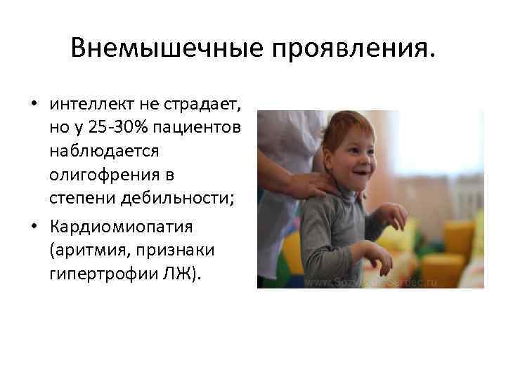 Внемышечные проявления. • интеллект не страдает, но у 25 -30% пациентов наблюдается олигофрения в