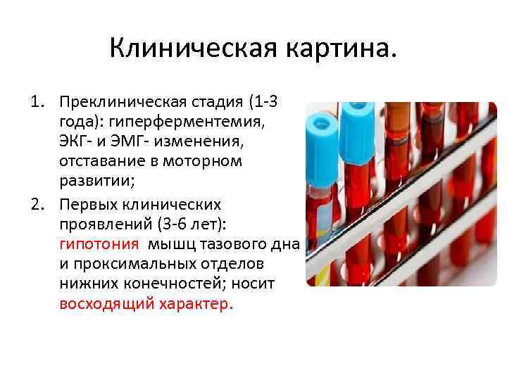 Клиническая картина. 1. Преклиническая стадия (1 -3 года): гиперферментемия, ЭКГ- и ЭМГ- изменения, отставание
