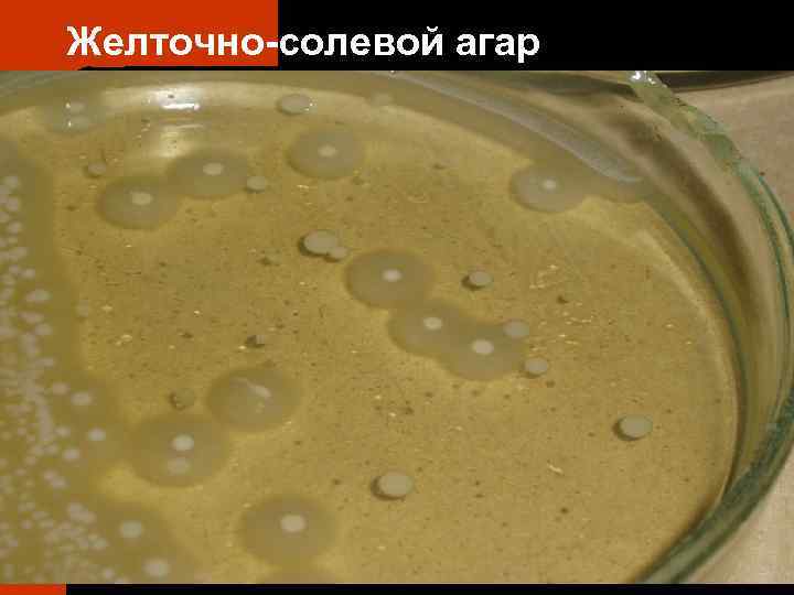 Желточно-солевой агар 