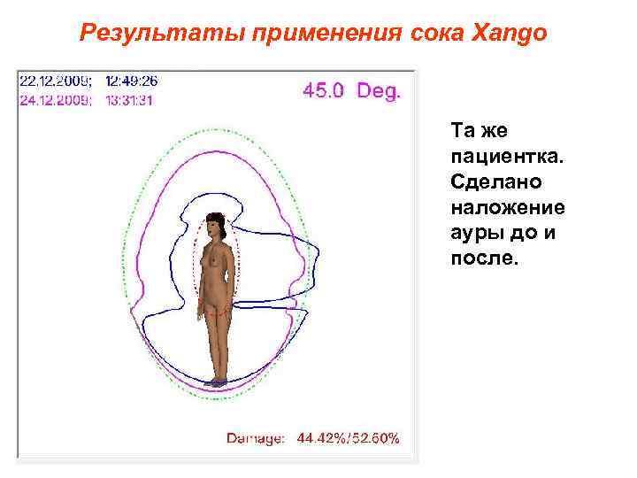 Результаты применения сока Xango Та же пациентка. Сделано наложение ауры до и после. 
