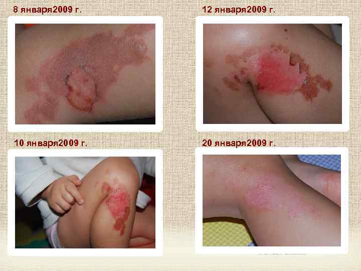 8 января 2009 г. 12 января 2009 г. 10 января 2009 г. 20 января