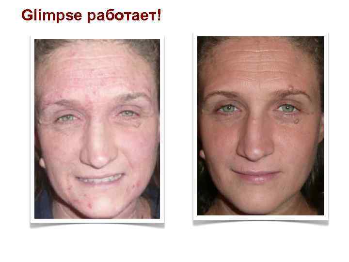 Glimpse работает! 