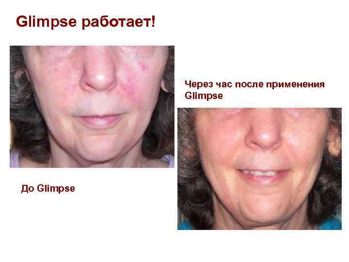 Glimpse работает! Через час после применения Glimpse До Glimpse 