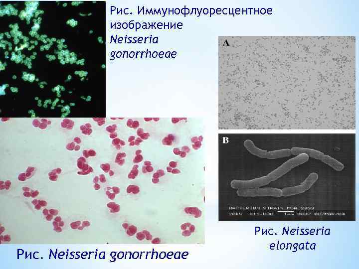 Рис. Иммунофлуоресцентное изображение Neisseria gonorrhoeae Рис. Neisseria elongata 