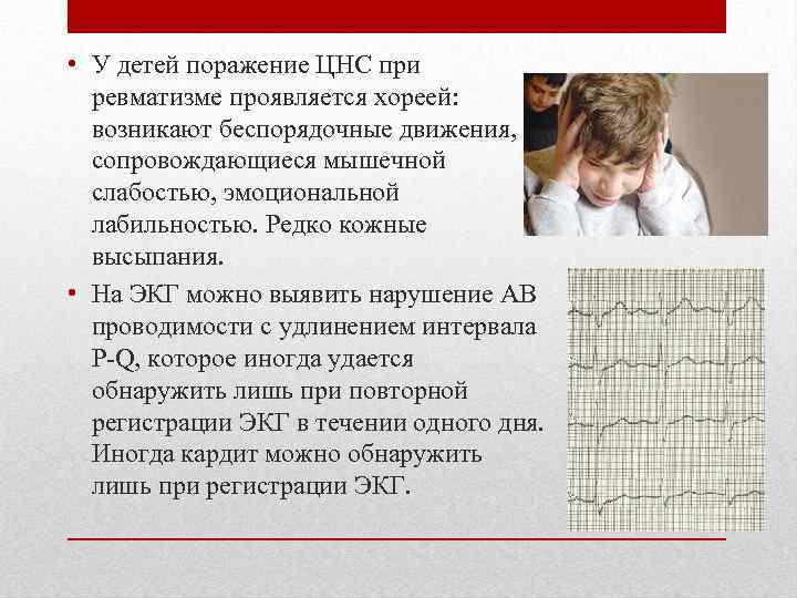  • У детей поражение ЦНС при ревматизме проявляется хореей: возникают беспорядочные движения, сопровождающиеся