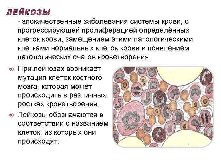 ЛЕЙКОЗЫ - злокачественные заболевания системы крови, с прогрессирующей пролиферацией определённых клеток крови, замещением этими