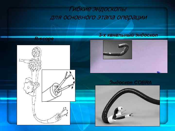 Гибкие эндоскопы для основного этапа операции R-scope 3 -х канальный эндоскоп Эндоскоп COBRA 