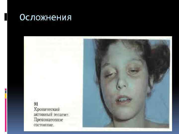 Осложнения 