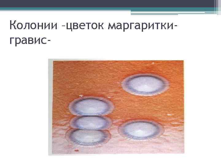 Колонии –цветок маргариткигравис- 