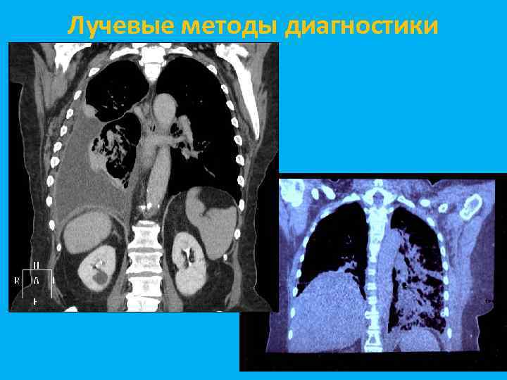 Лучевые методы диагностики 