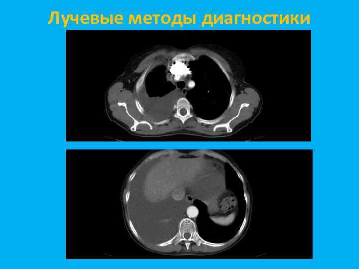 Лучевые методы диагностики 