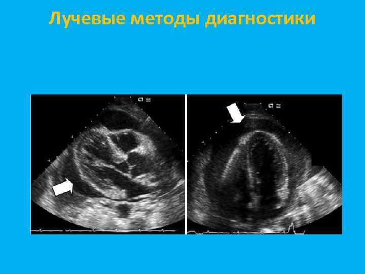 Лучевые методы диагностики 