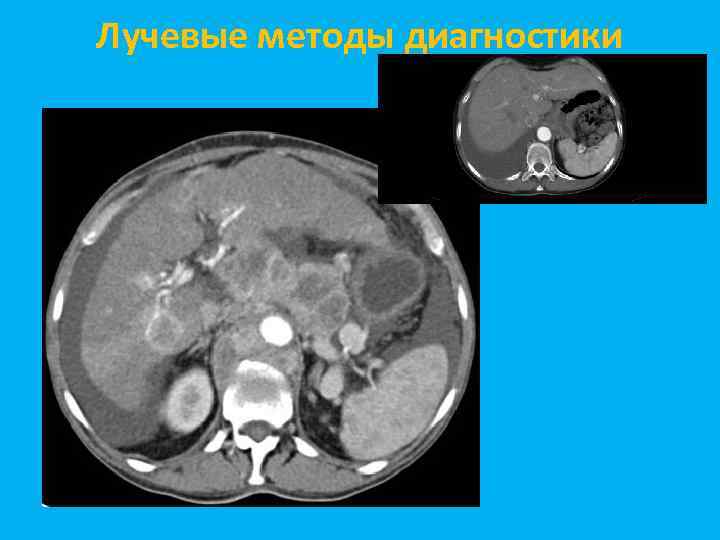 Лучевые методы диагностики 