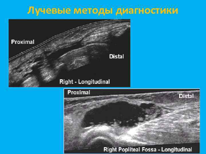 Лучевые методы диагностики 