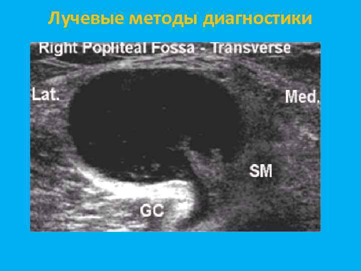 Лучевые методы диагностики 