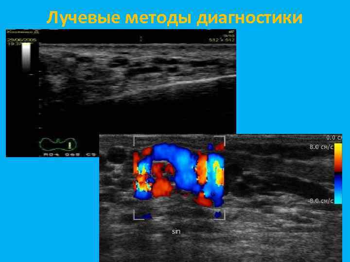 Лучевые методы диагностики 