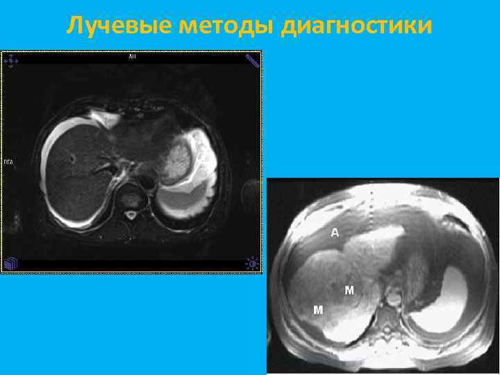 Лучевые методы диагностики 