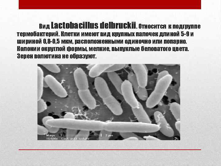 Вид Lactobacillus delbruckii. Относится к подгруппе термобактерий. Клетки имеют вид крупных палочек длиной 5