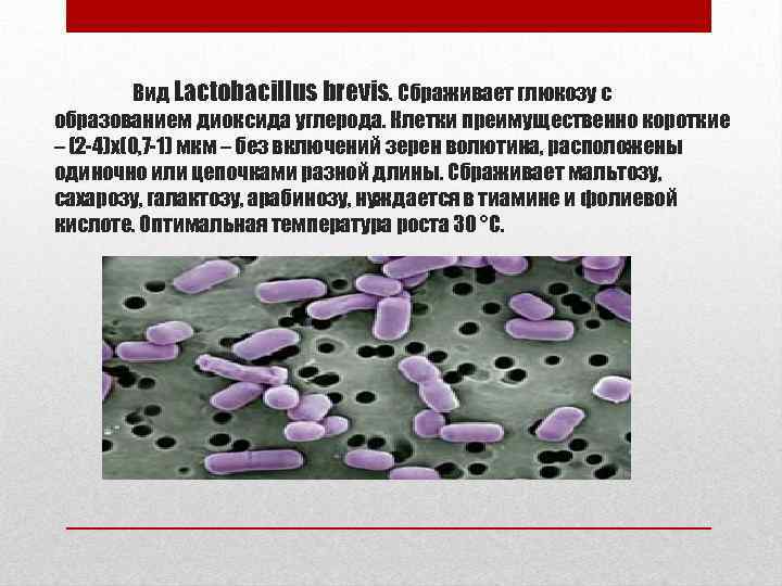 Вид Lactobacillus brevis. Сбраживает глюкозу с образованием диоксида углерода. Клетки преимущественно короткие – (2