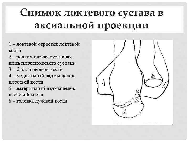 Снимок локтевого сустава в аксиальной проекции 1 – локтевой отросток локтевой кости 2 –