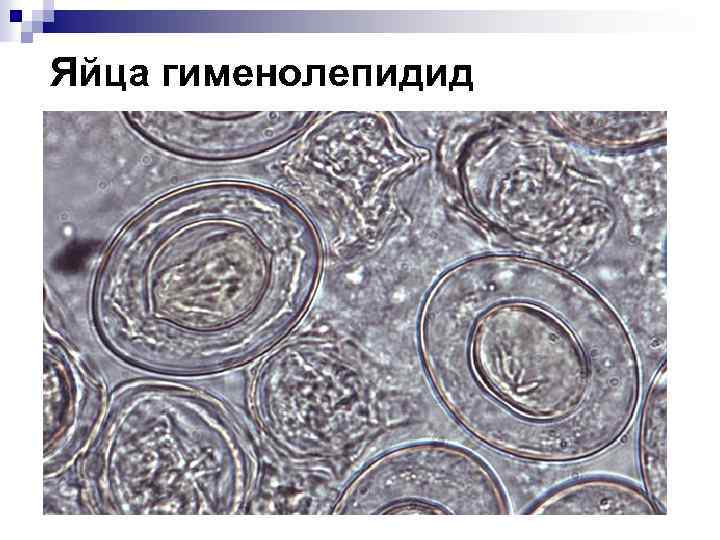 Яйца гименолепидид 
