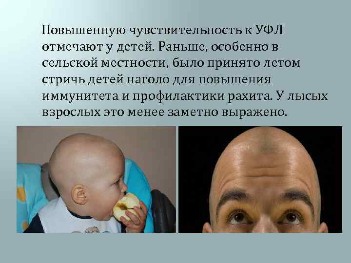  Повышенную чувствительность к УФЛ отмечают у детей. Раньше, особенно в сельской местности, было