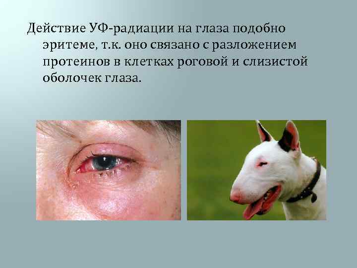 Действие УФ-радиации на глаза подобно эритеме, т. к. оно связано с разложением протеинов в