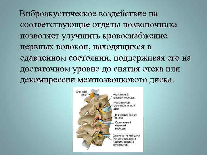  Виброакустическое воздействие на соответствующие отделы позвоночника позволяет улучшить кровоснабжение нервных волокон, находящихся в