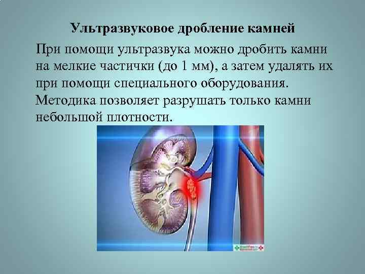 Ультразвуковое дробление камней При помощи ультразвука можно дробить камни на мелкие частички (до 1