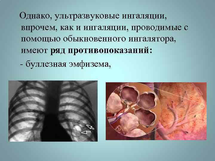 Однако, ультразвуковые ингаляции, впрочем, как и ингаляции, проводимые с помощью обыкновенного ингалятора, имеют ряд