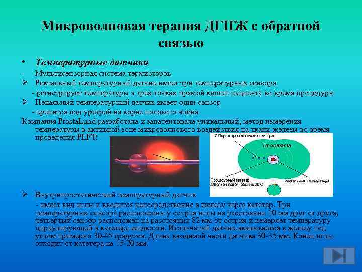 Микроволновая терапия ДГПЖ с обратной связью • Температурные датчики Мультисенсорная система термисторов Ø Ректальный