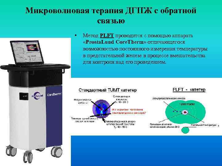 Микроволновая терапия ДГПЖ с обратной связью • Метод PLFT проводится с помощью аппарата «Prosta.