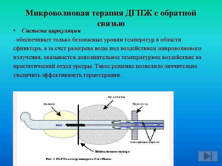 Микроволновая терапия ДГПЖ с обратной связью • Система циркуляции обеспечивает только безопасные уровни температур