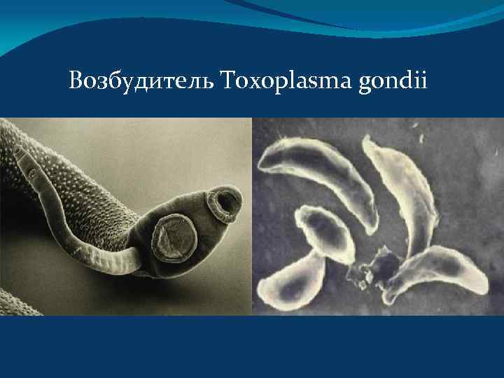 Возбудитель Toxoplasma gondii 