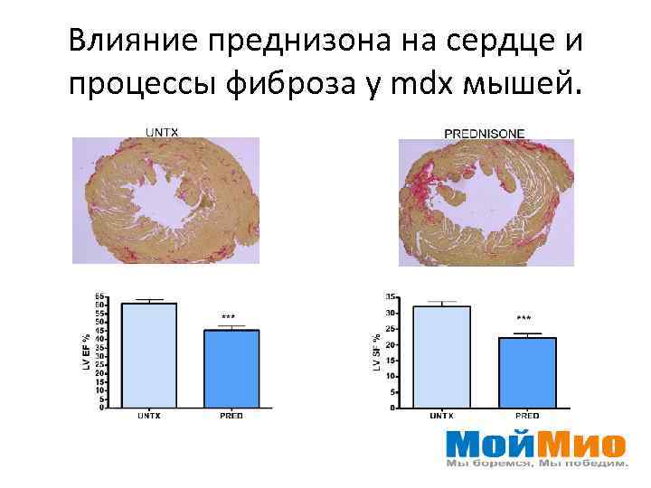 Влияние преднизона на сердце и процессы фиброза у mdx мышей. 