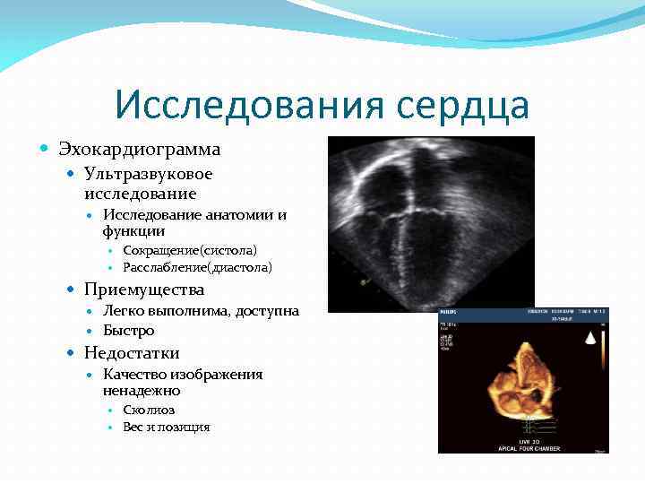 Исследования сердца Эхокардиограмма Ультразвуковое исследование Исследование анатомии и функции Сокращение(систола) Расслабление(диастола) Приемущества Легко выполнима,