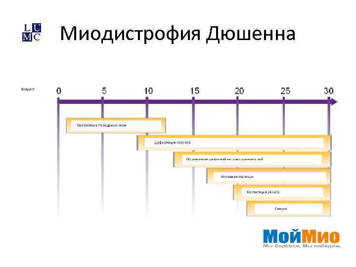 Миодистрофия Дюшенна 