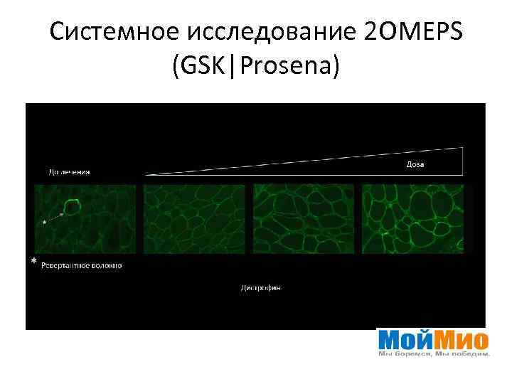 Системное исследование 2 OMEPS (GSK|Prosena) 