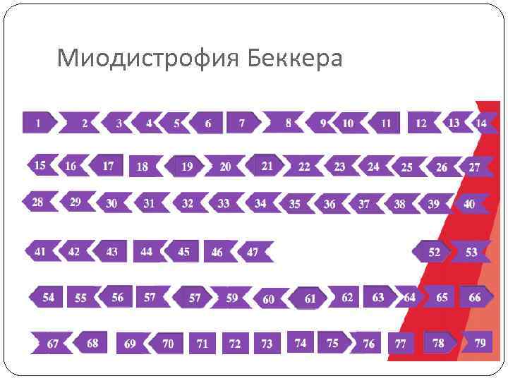 Миодистрофия Беккера 